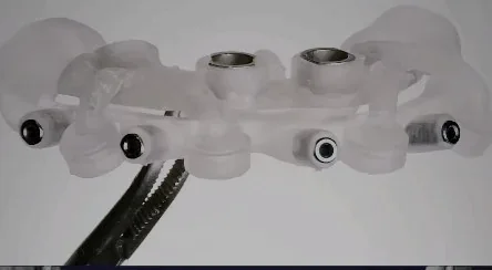 Guias cirúrgicos transparentes impressos