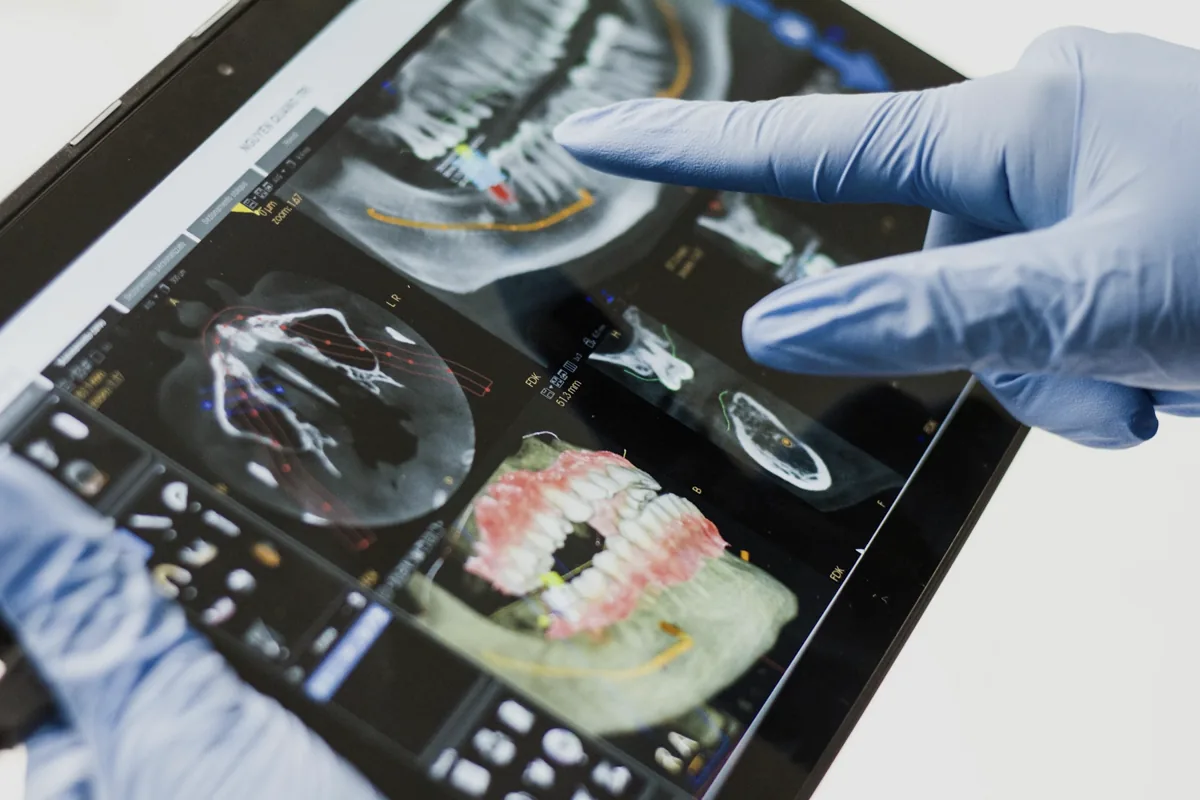 Dentista apontando para uma tomografia 3D da face num tablet